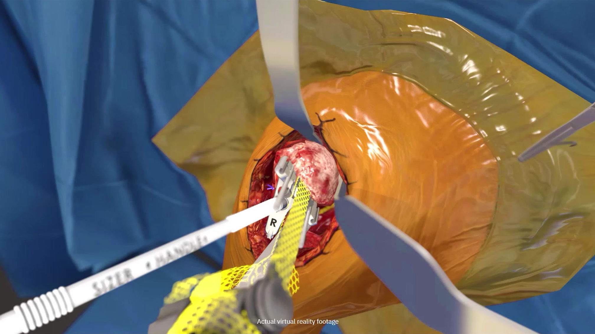 Upper extremity surgical training. Anytime. Anywhere.